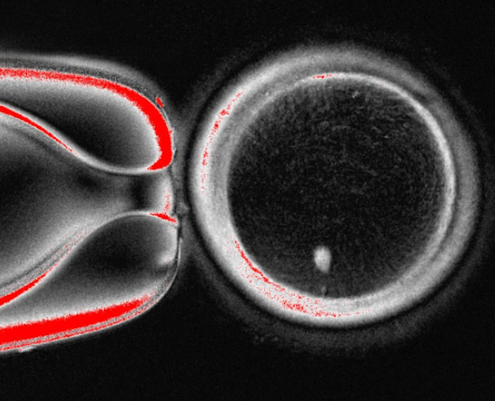 Ученые превратили клетки кожи в яйцеклетки: шаг к лечению бесплодия
