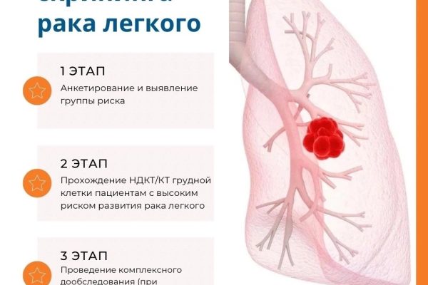 Телемедицина при хронической сердечной недостаточности