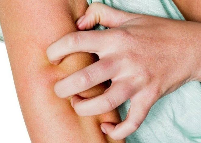 Зуд купальщика после пруда симптомы и помощь