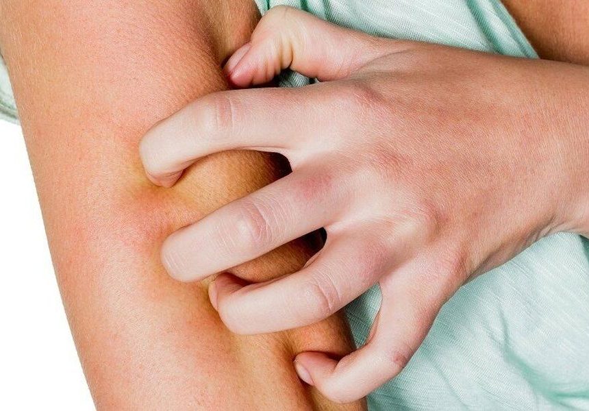 Зуд купальщика после пруда симптомы и помощь
